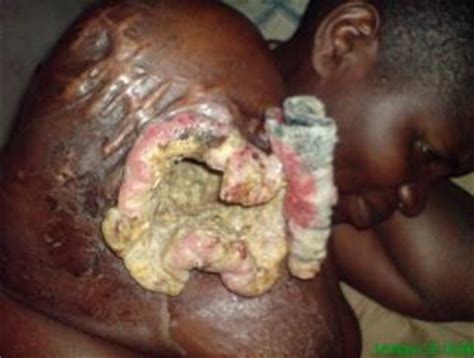 Results of topical, intravenous and oral therapy. Wunden - anamed edition