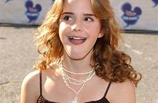 watson emma young awards disney kids channel fakes she years 2003 14 hot hermione when harry girl potter beautiful style