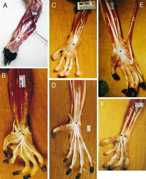 A deep cut on the palm side of your fingers, hand, wrist, or forearm can damage your flexor tendons, which are the tissues because flexor tendons are very close to the surface of the skin, a deep cut will most likely hit a flexor tendon. 4 Comparative morphology of the flexor digitorum profundus (FDP) (1)... | Download Scientific ...