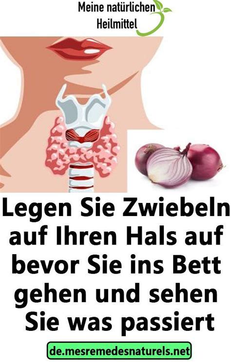 Ich wollte gerade ins bett gehen. Legen Sie Zwiebeln auf Ihren Hals auf bevor Sie ins Bett ...