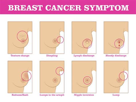Most benign breast lumps and conditions are directly related to your menstrual cycle, to fluctuations in your hormones and to the fluid buildup that comes with your monthly period. Breast Cancer, The Most Common Kind of Cancer in Women