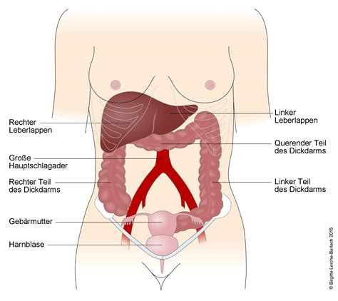 In höhe der rechten hungergrube⇒ corpus caeci: Appendizitis (Blinddarmentzündung), Laparoskopie - Deximed