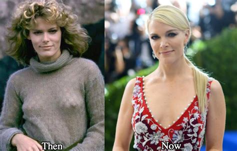 It's a food product, essentially. bill o'reilly went on to defend the officer saying, i don't think we have. Megyn Kelly Plastic Surgery Before and After Photos