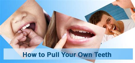 I won't let the dentist take it out cuz. Learn: How to Pull Your Own Teeth - LifeCycleBlog.com