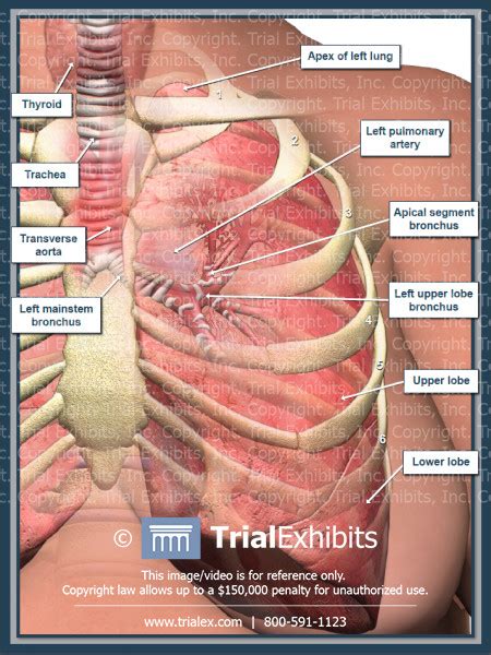 Rib cage or thoracic cage is the arrangement of. Stomach Ribs Lungs Picture - Reverse X Ray Image Of A Male ...