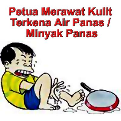 Bila kondisi ini terjadi, segera lakukan hal ini untuk mencegah komplikasi: Kuala Nerang: Petua merawat kulit terkena air / minyak panas.