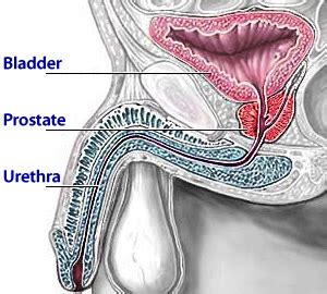 Treatment can help to control the cancer and your symptoms. Prostate Cancer - Symptoms and Treatment