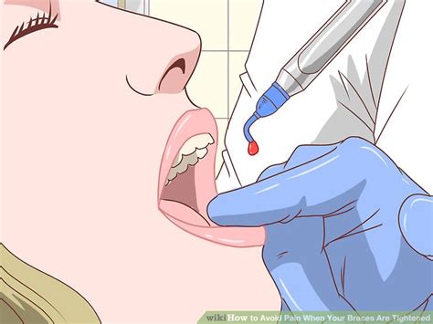 The smoother texture will prevent any pain too raw areas inside of your mouth. How to Avoid Pain When Your Braces Are Tightened: 14 Steps