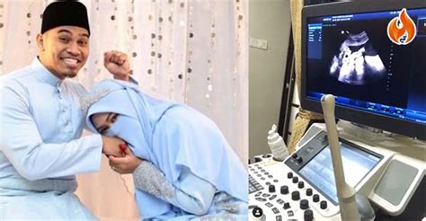 Dengan teknologi terkini dan modern, perawatan kecantikan untuk kulit bisa dilakukan dengan aman dan nyaman. Netizen Meluat PU Abu Muat Naik Video Ultrasound Anak ...