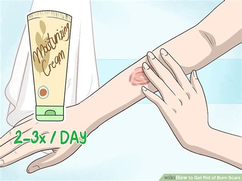 You can purchase silicone sheets through your doctor. 3 Ways to Get Rid of Burn Scars - wikiHow