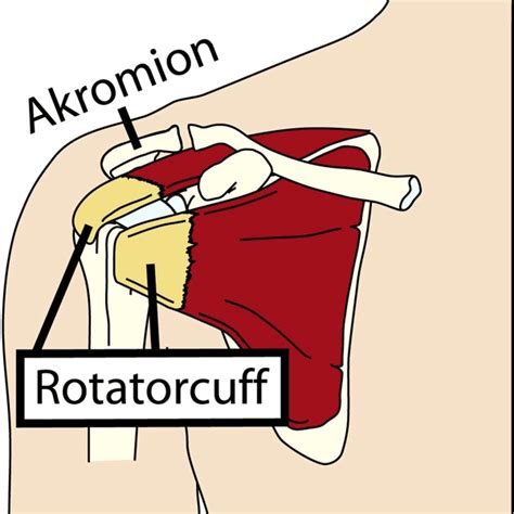 Iii, fu f.h., hawkins r.j., editors. Impingement - inklämd sena • Södermalms ortopedi