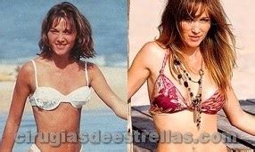 Jimena baron antes y despues cirugias. Veronica Lozano antes y después