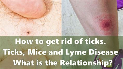 Check spelling or type a new query. How to get rid of ticks. Ticks, Mice and Lyme Disease ...