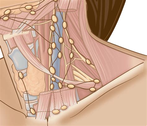 Classification, levels, anatomy, diagram, diagnosis and cervical lymph nodes are part of you lymphatic system which also includes other organs, tissues, and they are also referred to as neck lymph nodes. Metastatic Lymph Nodes ‣ THANC Guide