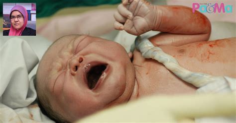 Meskipun gerakan si kecil bermacam2. Doktor Kata Tali Pusat Lilit Leher Bayi Dalam Kandungan ...
