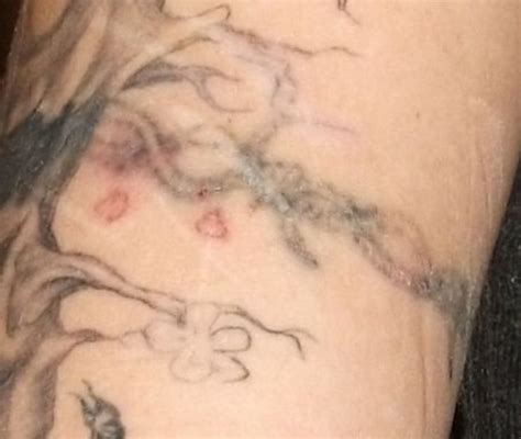 To use lemon juice to fade tattoos, cut a lemon into two halves and then squeeze out its juice. My Experience Lightening and Removing My Tattoo at Home ...