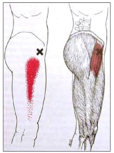 They also help to stabilize the spine. Pin by Tomasz Chmielewski on rehabilitacja | Trigger points, Hip flexor, Tensor fasciae latae