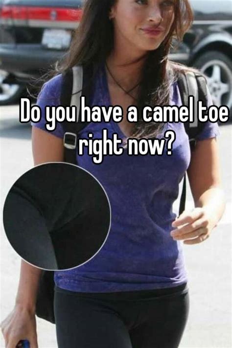 Yes guys can have a camel toe on the head of the penis. Do you have a camel toe right now?