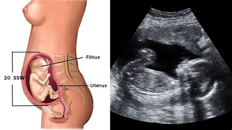 Ernährung von kindern vom baby bis ins schulalter. Entwicklung vom Embryo zum Fötus: Grafiken, Bilder und ...