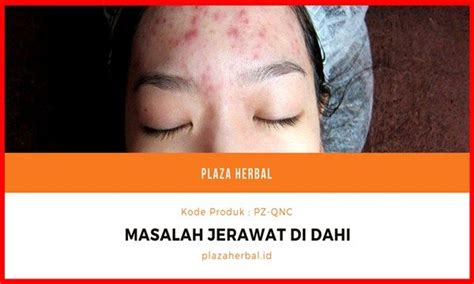 We did not find results for: Cara Menghilangkan Jerawat Kecil Kecil Di Jidat | Jerawat ...