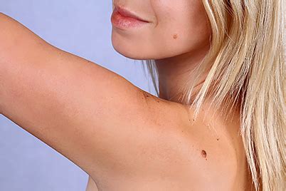 Some warning signs of breast cancer are— new lump in the breast or underarm (armpit). How can I tell if I have skin cancer - Rogers , AR ...