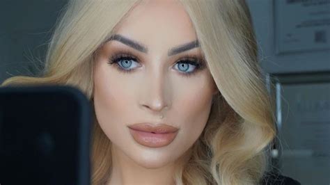 Post not marked as liked3. Aline Bachmann Op / Heftige Vorwürfe: Ex von Aline ...