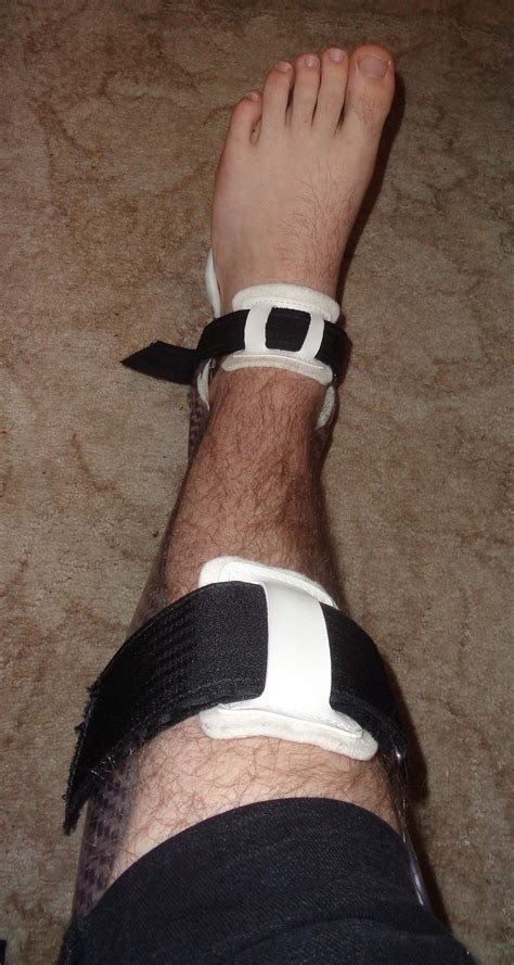 See more ideas about orthopedic brace, braces, orthopedics. Splint (medicine) - Wikipedia