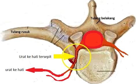 Sebagaimana yang diriwayatkan dalam shahih bukhari, apakah memang benar hawa itu diciptakan dari tulang rusuk nabi adam? Prissna Wellness & Therapy Centre (Pusat Rawatan PRISSNA ...