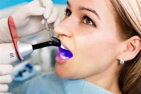 Proper cleaning prevents infection and promotes healing. Answering The Most Commonly Asked Questions About Fillings
