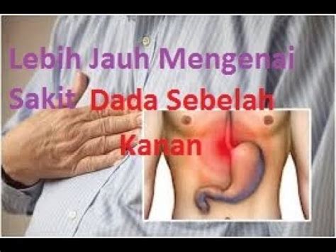 Dalam hal ini, rasa sakit di sebelah kanan atau kiri sering dilengkapi dengan. YUK!! Lebih Jauh Mengenai Sakit Dada Sebelah Kanan - YouTube