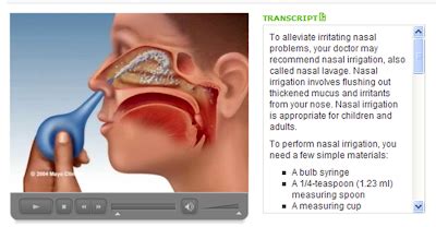 Tw is an abbreviation for throat washing. Nasal Wash Information: What is Nasal Washing?