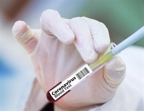 Interim results from phase 3 trials in britain and brazil found the vaccine to be 70.4% protective. AstraZeneca plans to produce 2 billion doses of the Covid ...