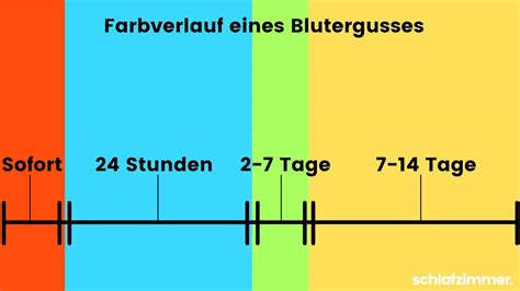 Currently, sepsis is commonly defined as the presence of infection in conjunction with. Blauer Fleck geht nicht weg: Das solltest du unbedingt tun!