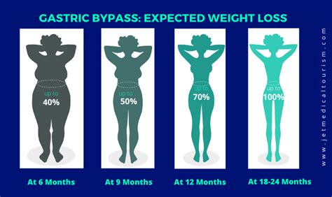Particularly with the degree of surgery and the post operative care, this should insurance coverage of part of gastric surgery may be available provided requirements are met. What is Gastric Bypass Surgery? - Jet Medical Tourism® in Mexico