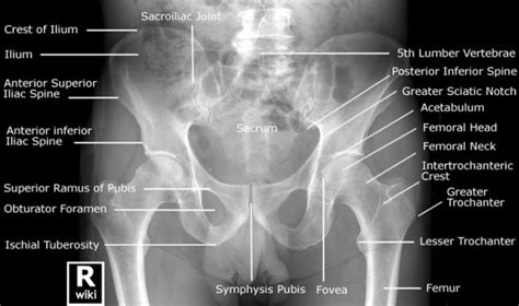 Anteroposterior and oblique views are most common views that are ordered on the foot. Pelvic X-ray의 Anatomy와 Positioning : 네이버 블로그