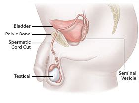 We did not find results for: Vasectomy Reversal - Get Treatment Cost & Clinics in Nepal