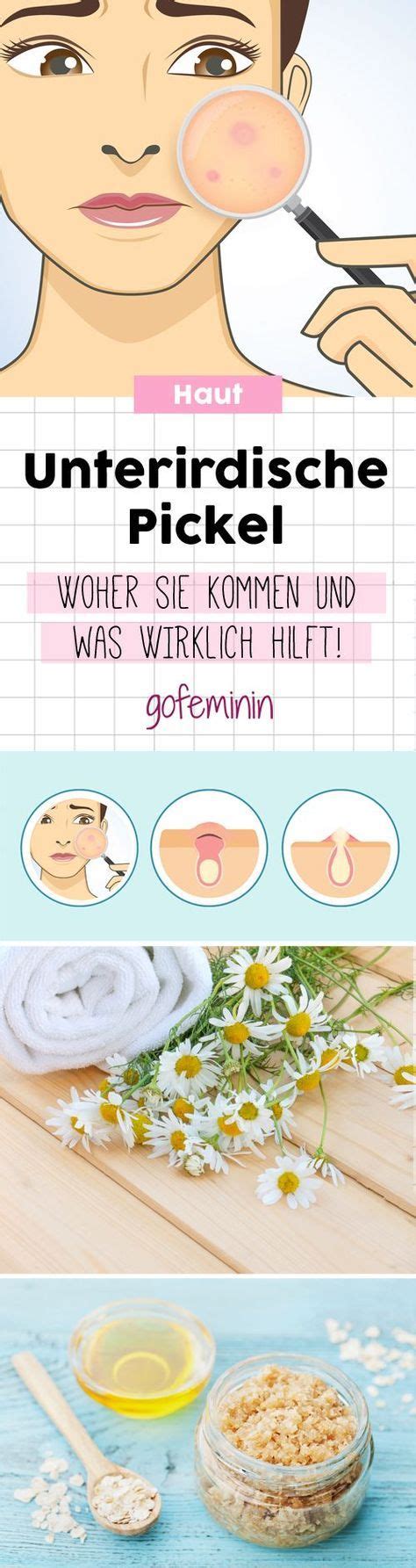 Natürlich habe ich schon versucht es mit einer. Unterirdische Pickel: Woher sie kommen und was WIRKLICH ...