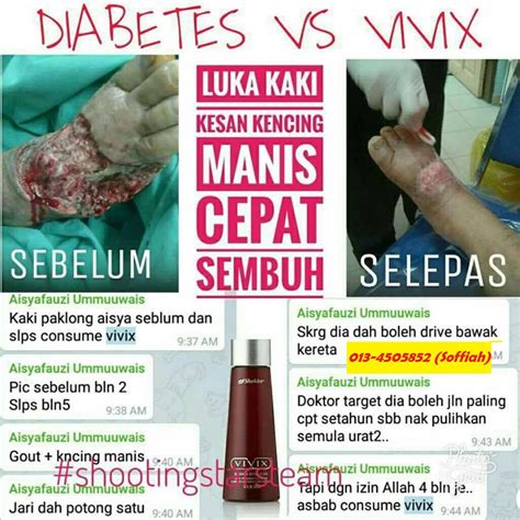 Rawatan diabetes kencing manis di rumah. Rawatan Luka Kencing Manis Paling Cepat Sembuh Dan ...