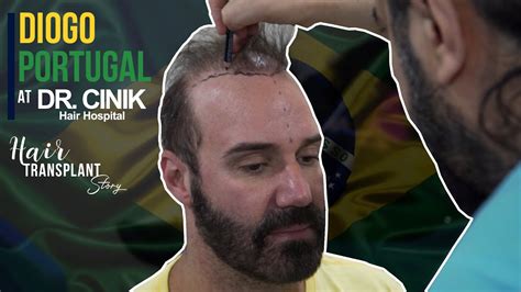 Nova esperança sp são paulo. DIEGO PORTUGAL | Transplante de cabelo | Hair Transplant ...