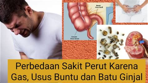 Sakit perut atau sakit di bahagian abdomen adalah salah satu sebab biasa mengapa ibu bapa selalu membawa anak berjumpa doktor. Perbedaan Sakit Perut karena Gas, Usus Buntu atau Batu ...