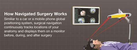 This helps the surgeons to know exactly where the implant is to. What is Image Guided Surgery? - Brainlab.org