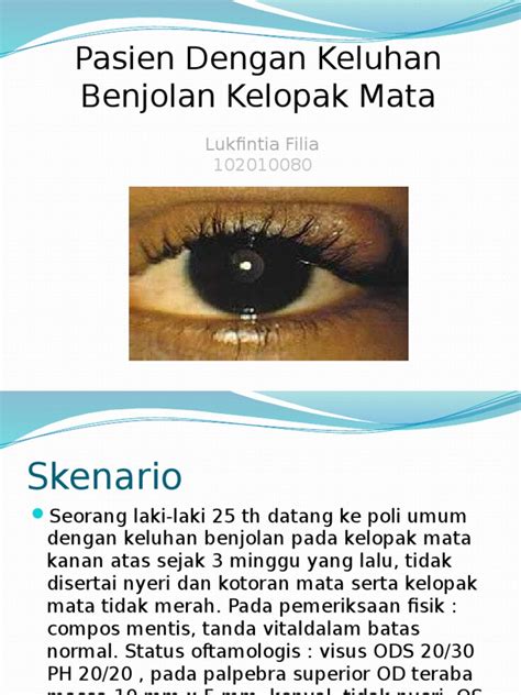 Kedutan mata dapat terjadi di salah satu atau kedua bagian mata, baik di bagian kelopak atas atau bawah mata. Benjolan Di Kelopak Mata Bagian Atas - Berbagai Mata