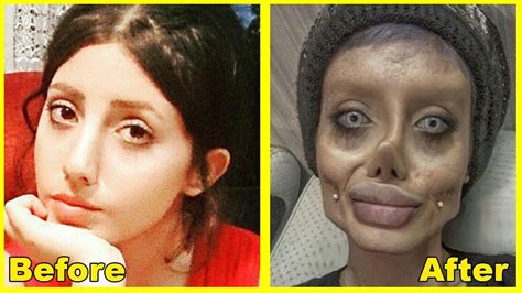 Find the highest rated plastic surgery apps for iphone pricing, reviews, free demos, trials, and more. Sahar Tabar - Before & After Plastic Surgery | Corpse ...