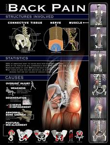 Lower Back Why How And Where Infographic