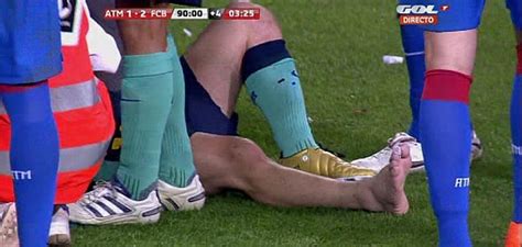 Los tapones del colombiano impactaron en el costado interno del pie izquierdo de messi, que cayó al piso. ¿Te acuerdas cómo fue la última lesión de Leo Messi? - Taringa!