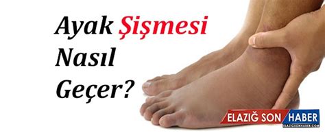 Ayagin boyuna 43 enine 26 numara olmasi. Ayak şişmesi neden olur, ne iyi gelir? Ayak şişmesi nasıl ...