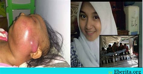 Gigi geraham bungsu yang sakit biasanya disebabkan oleh impaksi, atau kondisi gigi yang masih tertutup gusi. Viral : Sedih !!! Gadis Cantik Ini Maut Selepas Mencabut ...