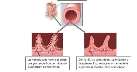 Curso gratuito (formación 100% subvencionada). El Magazin de Merlo: Cocina para CELIACOS: Jornada "MERLO ...