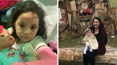 Is this hurt a recent thing, or old? Harris Co. mom killed and 2-year-old daughter injured in crash with drunk driver - ABC13 Houston