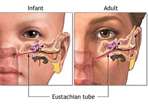 Protect the inner ear from nasal secretions; Eustacian Tube Dysfunction